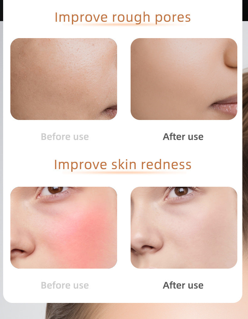 OptiLume Led light Masker